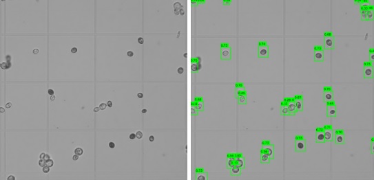 Microscopio de levaduras